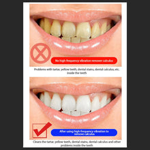 Load image into Gallery viewer, Multifunctional Intelligent Dental Scaler Ultrasonic dental scaler SP